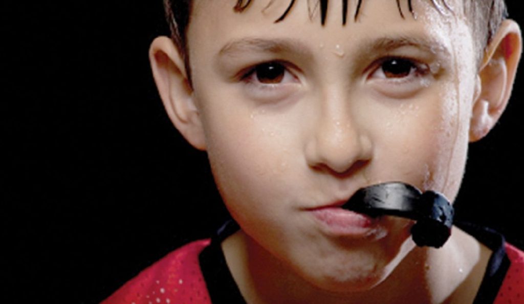 Sports Mouth Guard Dentist