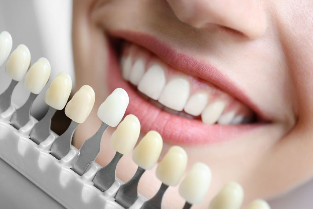 Dental Implants Mississauga