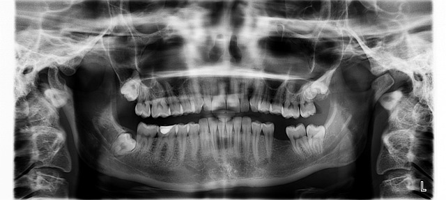 Orthopantomogram