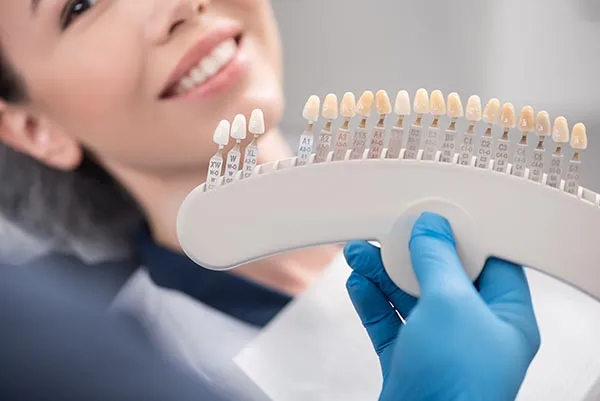 cosmetic-dental-bonding-f