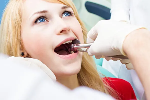 tooth extraction